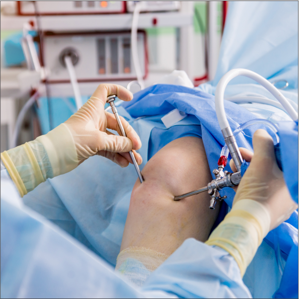 Orthopaedic Surgery Image